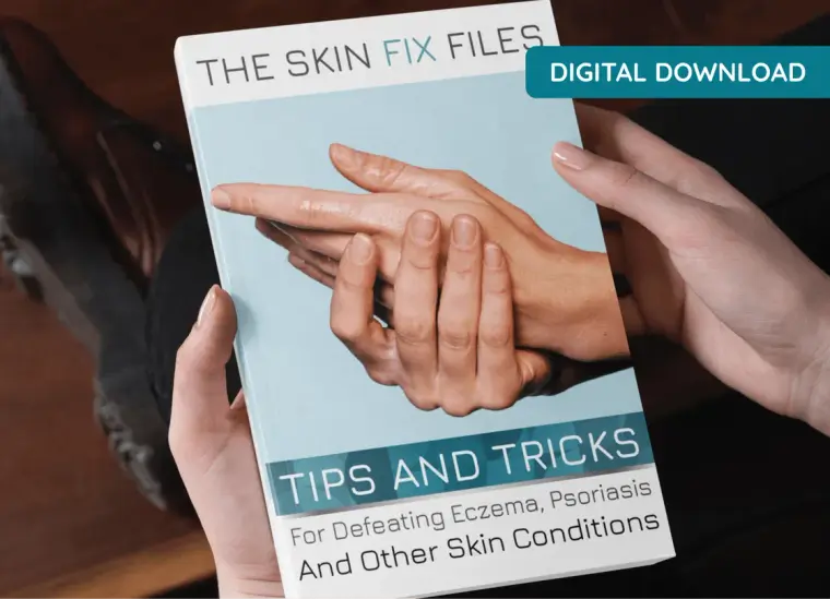 Bonus guide: The Skin Fix Files